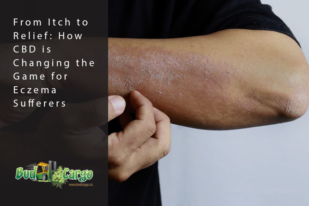 bcargo blog eczema sufferers